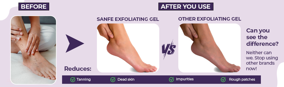 Sanfe Instant Tan & Dead Skin Removal Exfoliating Gel