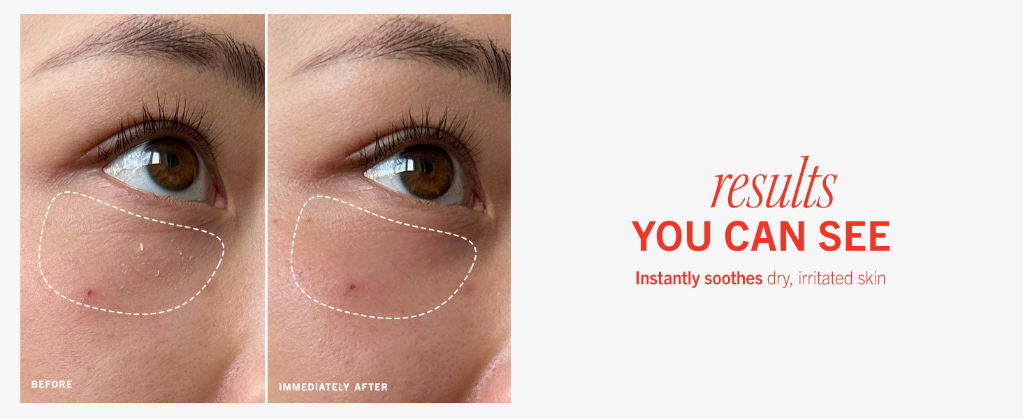 results you can see instantly soothes dry, irritated skin